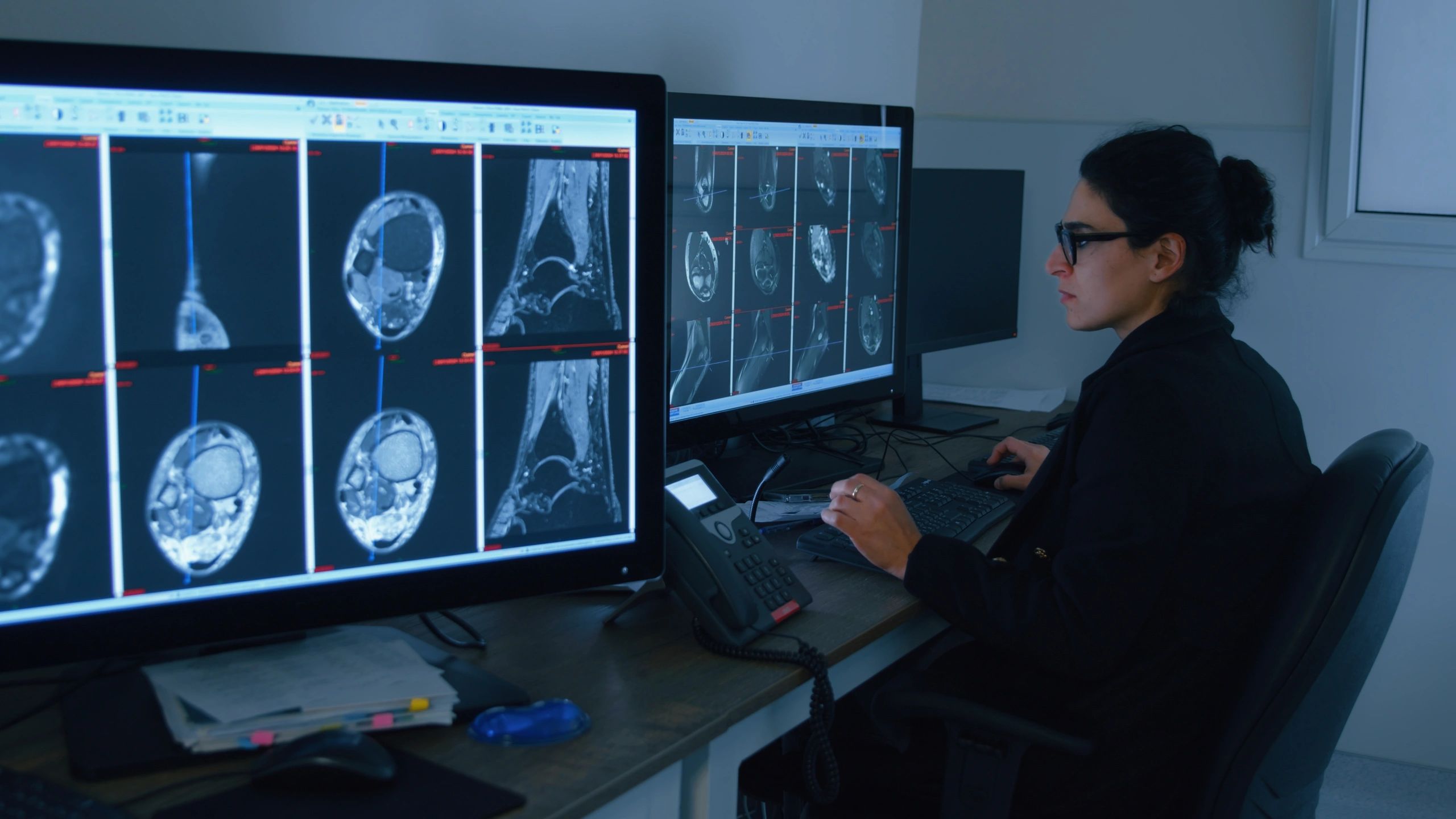 Doctor reviewing MRI scans on computer monitors